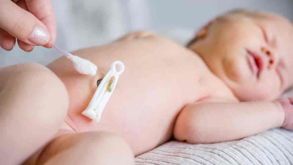 Cordão umbilical: aumentam sobrevivência de doentes oncológicos