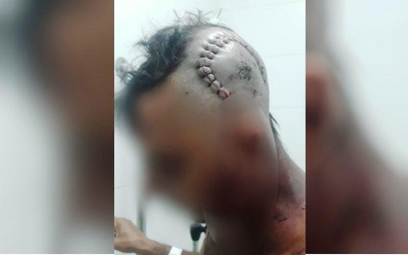 Fazendeiro é suspeito de tentar matar funcionário com golpes de facão