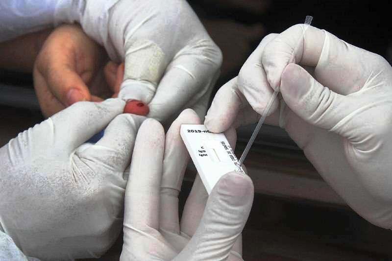 Inquérito sorológico: governo inicia testagem rápida em 32 mil capixabas na semana que vem