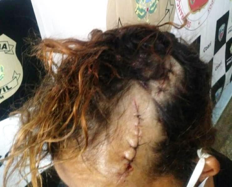 Peixeiro não aceita separação e tenta matar ex a terçadada