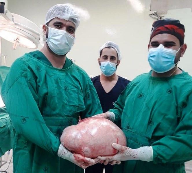 Tumor de quase 20 quilos é retirado do ovário de uma jovem