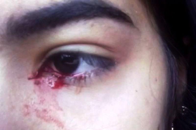 Adolescente chora sangue e intriga família