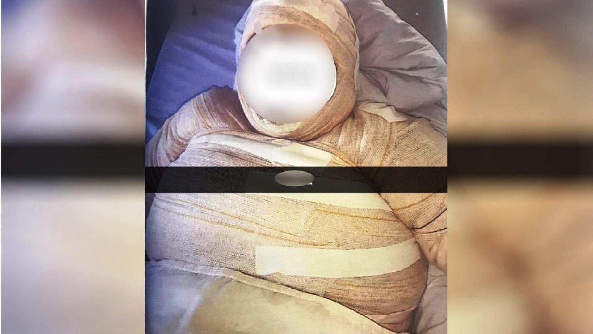 Mulher é presa suspeita de atear fogo na namorada por ciúmes