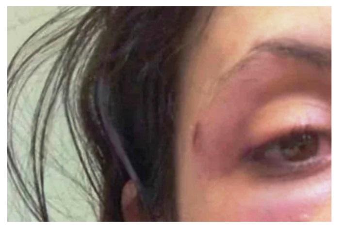 Marido enforca e agride mulher após flagrar mensagem em celular