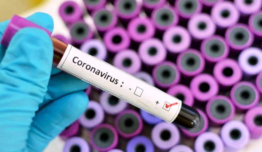 Conceição da Barra registra mais 3 infectados por Covid-19; casos soma 412
