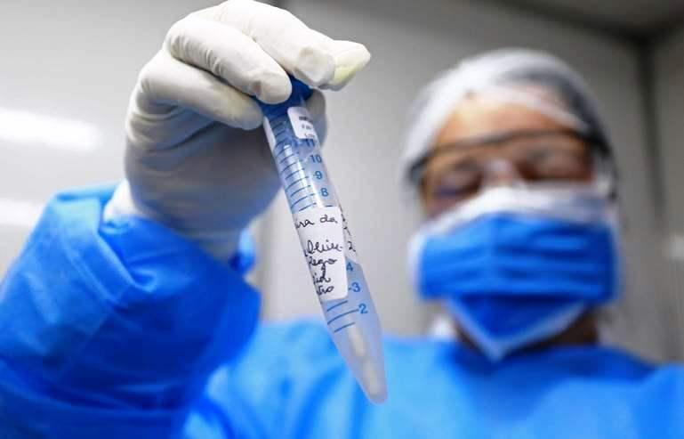 Espírito Santo contabiliza 4.727 mortes por Covid-19; casos atinge 225.358