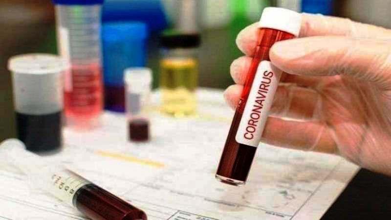 Conceição da Barra tem 3 novos infectados por coronavírus; total de casos chega a 565
