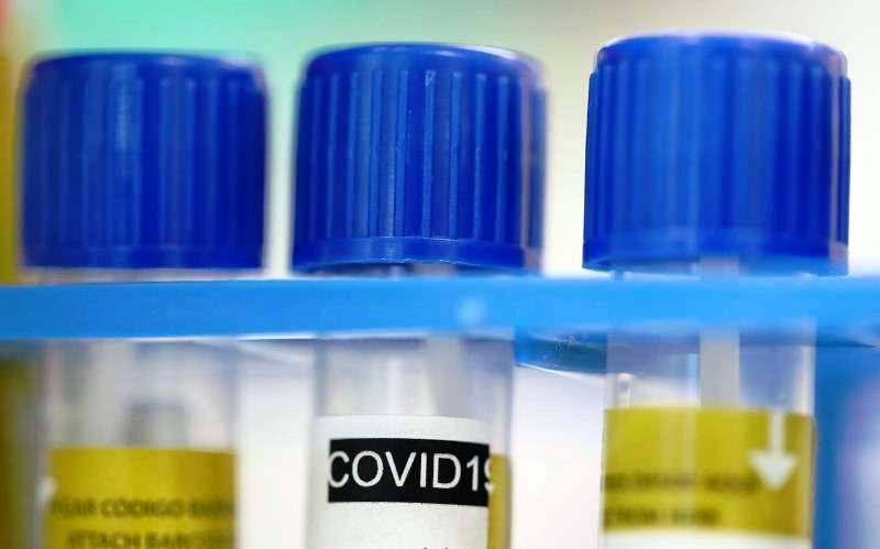 Espírito Santo registra 800 novos casos por Covid-19; total de infectados ultrapassa 285.6 mil