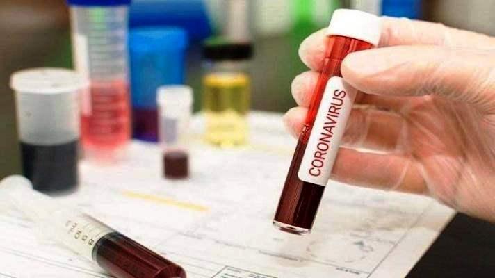 Conceição da Barra soma 7 infectados por coronavírus em 24 horas; casos confirmados chega a 747