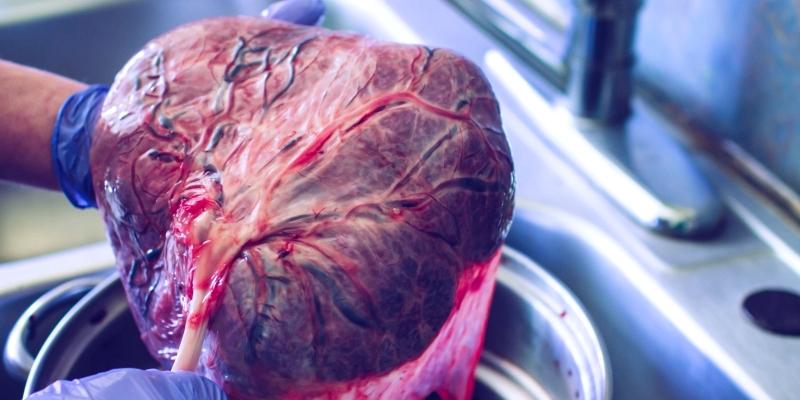 Comer placenta é uma prática natural ou é maluquice?
