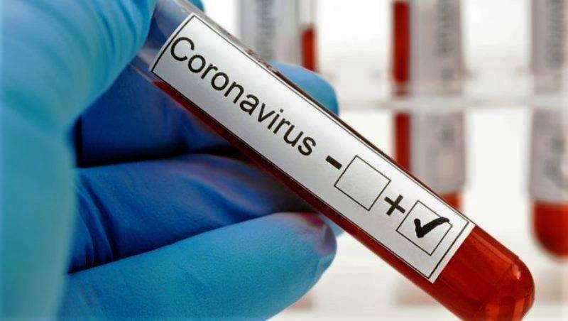 ES registra 1.987 infectados por Covid-19 em 24 horas e casos vai a 466.240 