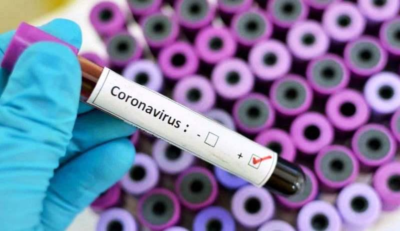 Conceição da Barra tem mais 3 infectados pela Covid-19 e vai a 1.576 casos confirmados 