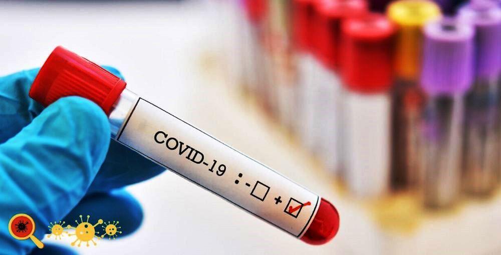 ES registra mais 47 mortes pela Covid-19 e 1.229 infectados em apenas 24 horas