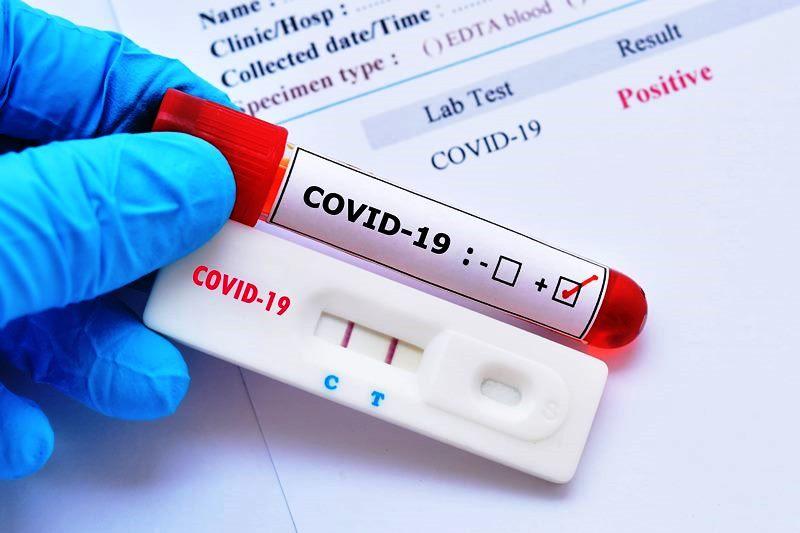 Conceição da Barra registra 1 caso de Covi-19 e total de infectados chega a 1.579