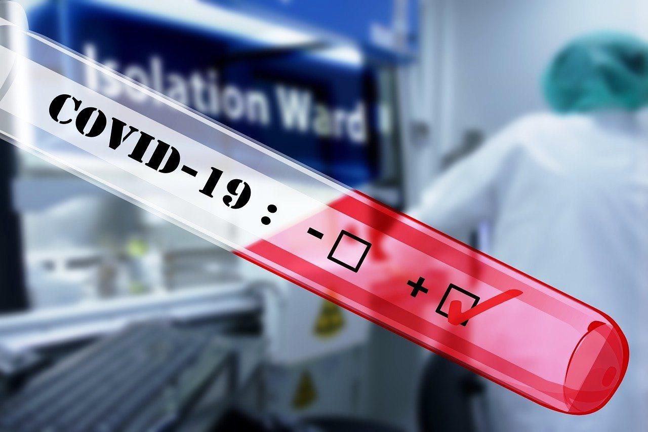 ES tem registra mais 661 infectados pela Covid-19 e contabiliza 507.2 mil casos