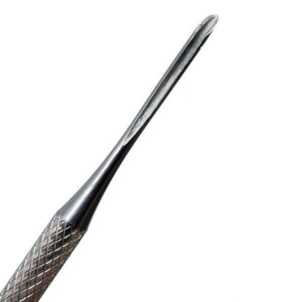 4 aparelhos incríveis usados para desencravar unhas
