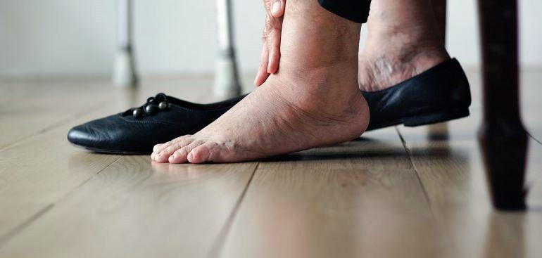 Pés inchados? Veja quais são alguns truques para se livrar deles