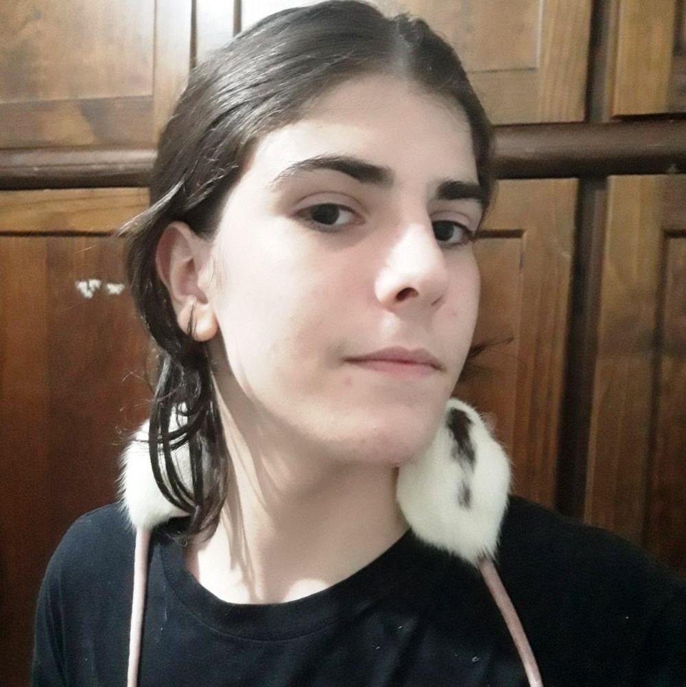 Adolescente descobre câncer e terá que amputar braço deformado