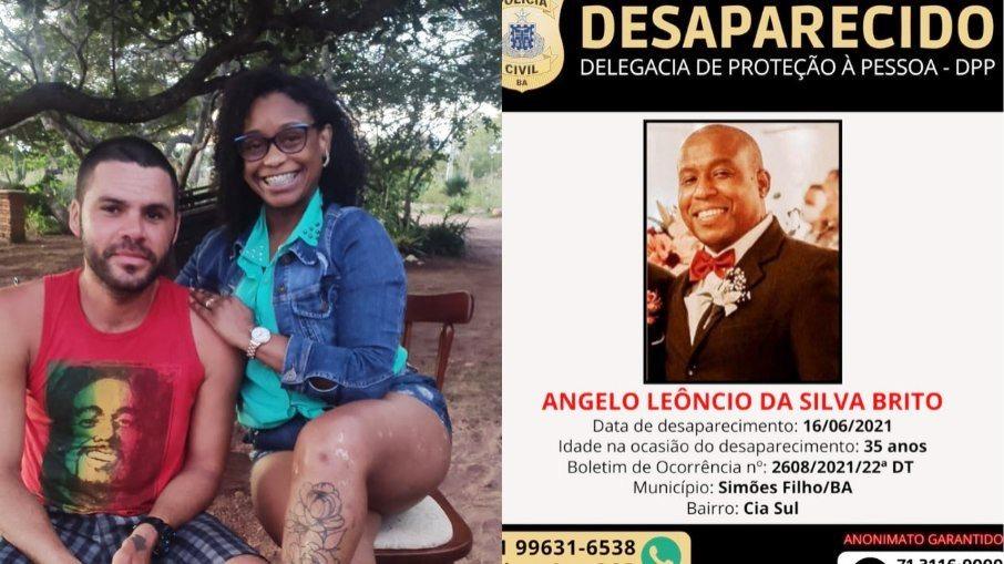 Vitiligo: “Ouvia das pessoas que era bonita, pena que tinha a pele manchada”