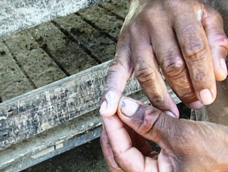 ES investiga quatro casos suspeitos de varíola bovina em humanos