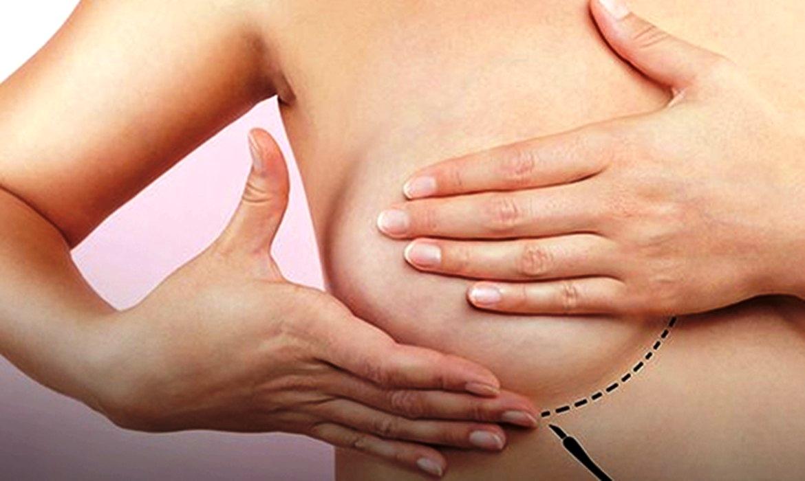 Mamografias podem ter alterações após vacina contra Covid-19