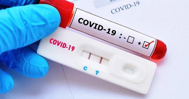 ES registra apenas 3 mortes e 401 casos de Covid-19 neste domingo (18)