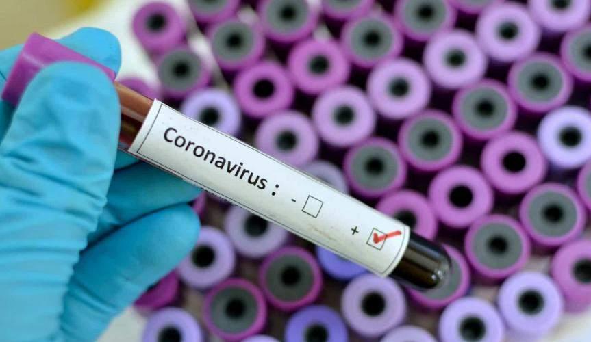 Conceição da Barra tem mais 3 casos de Covid-19 e total de infectados sobe para 1.842