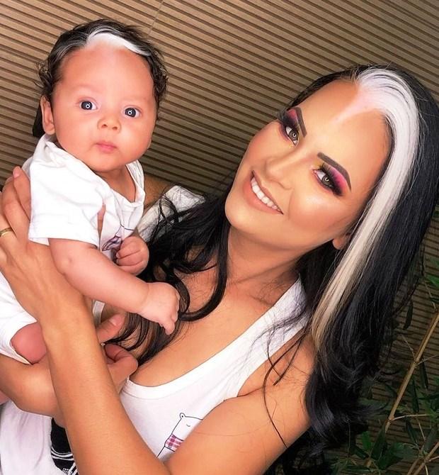 Mãe e bebê com condição rara fazem sucesso nas redes sociais: “Perguntam se pintamos os cabelos”