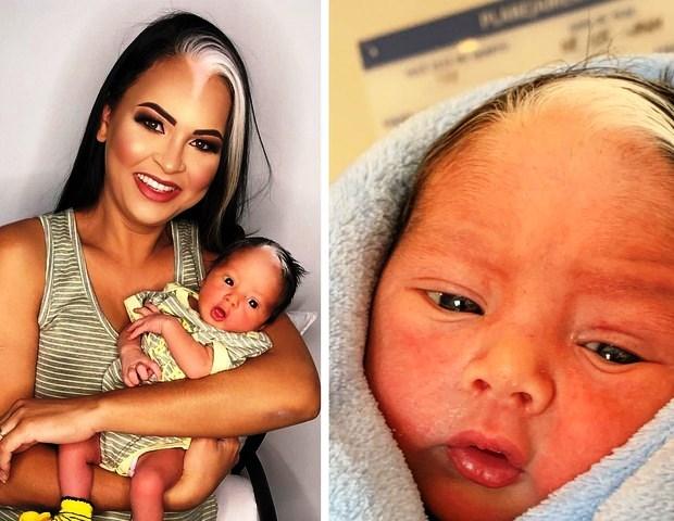 Mãe e bebê com condição rara fazem sucesso nas redes sociais: “Perguntam se pintamos os cabelos”