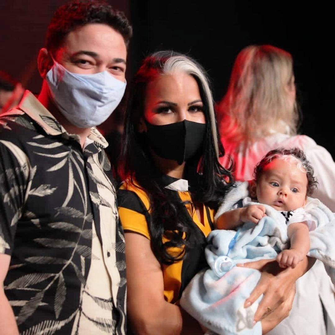 Mãe e bebê com condição rara fazem sucesso nas redes sociais: “Perguntam se pintamos os cabelos”