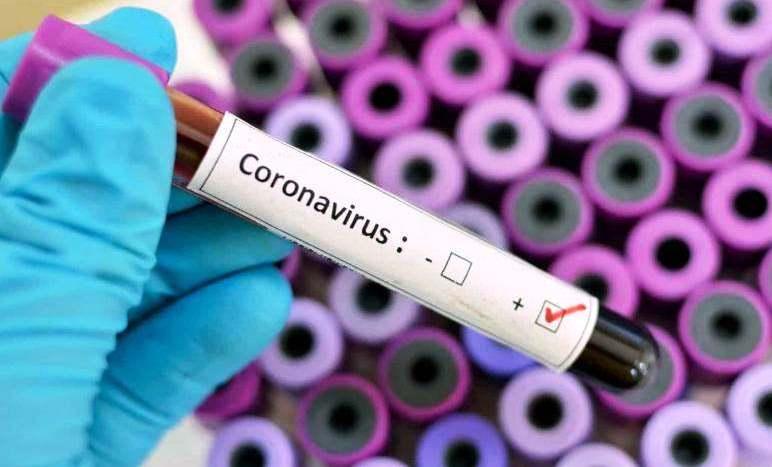 Conceição da Barra tem 6 novos infectados pela Covid-19 e vai a 1.929 casos