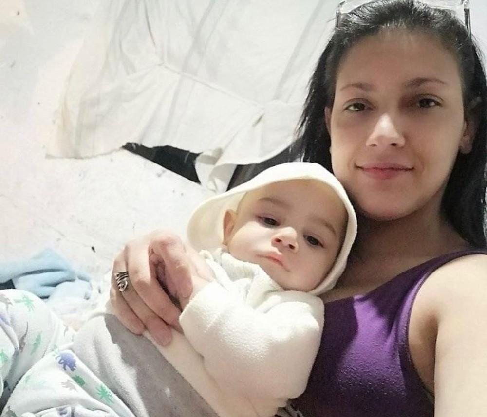 Mulher que teve 90% do corpo queimado ao usar álcool para cozinhar, segue em estado grave