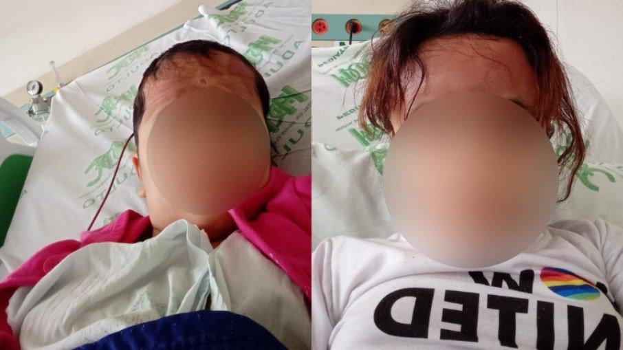 Menina de 9 anos fica 21 dias internada e quase cega após escova progressiva