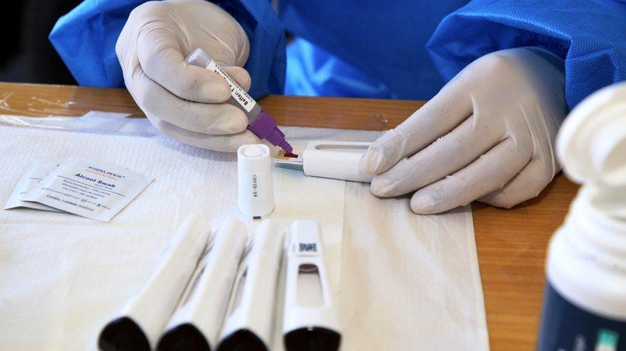 Brasil tem 590.955 mil mortes; 203 nas últimas 24 horas