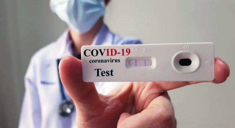 ES registra 986 novos infectados por Covid-19 e chega 579.781 casos confirmados