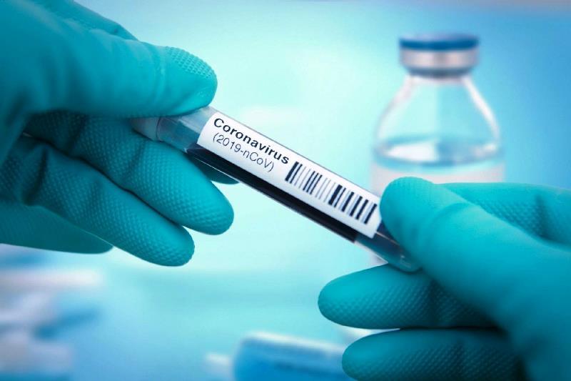 Conceição da Barra tem mais 2 infectados pela Covid-19 e soma 2.006 casos confirmados