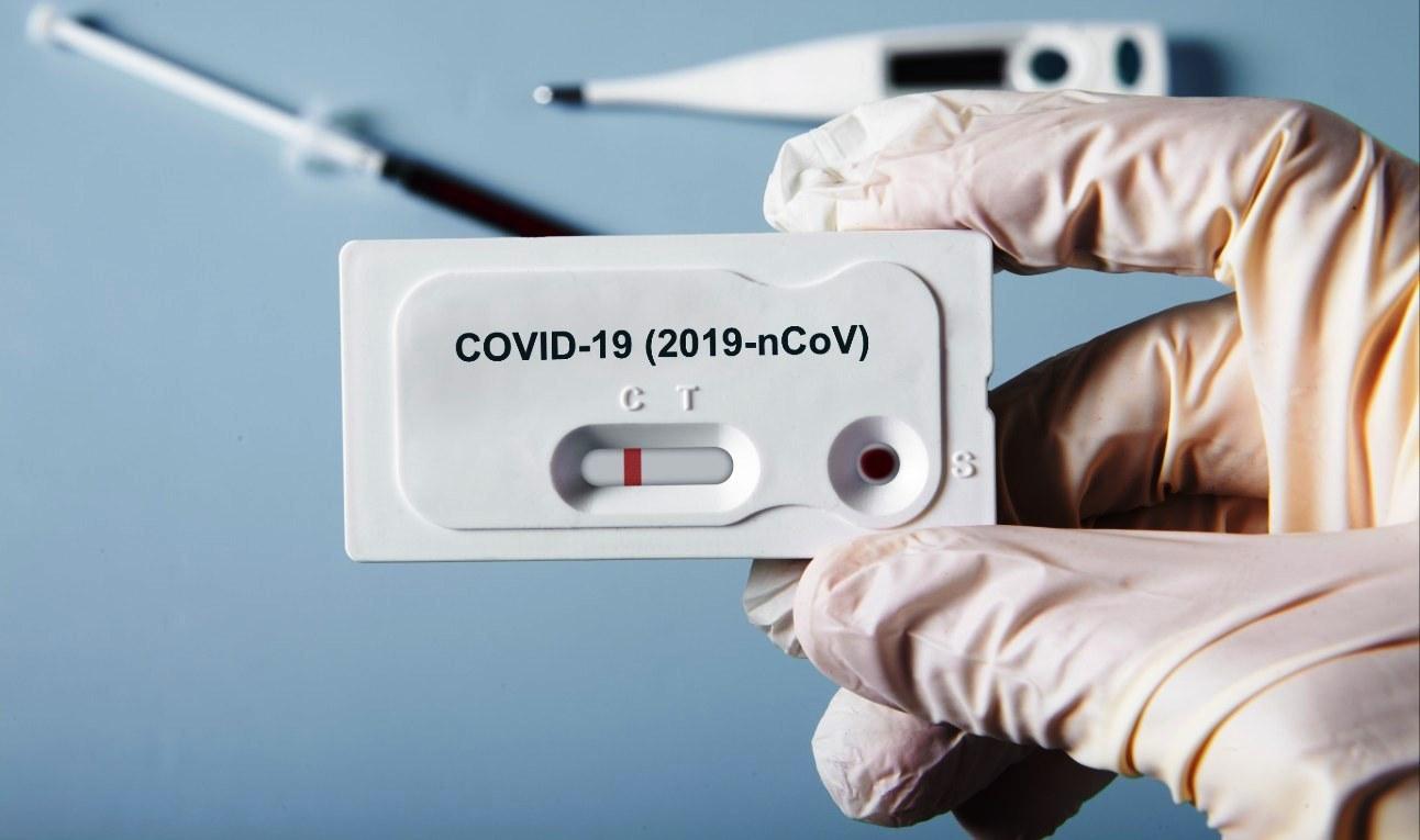 ES registra 903 casos de Covid-19 e apenas 2 mortes pela doença, neste sábado (25)