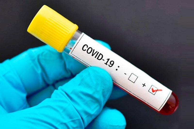 Conceição da Barra tem 66 vidas perdidas pela pandemia e 2.013 casos de Covid-19