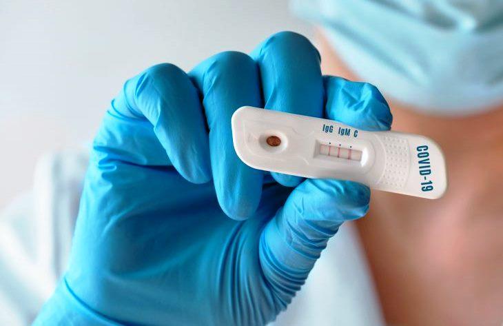 Conceição da Barra tem mais 1 infectado pela Covid-19 e vai a 2.021 casos da doença