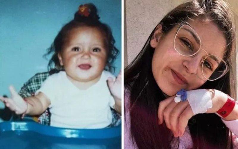 Após tomar soda cáustica quando criança, jovem já passou por 14 cirurgias