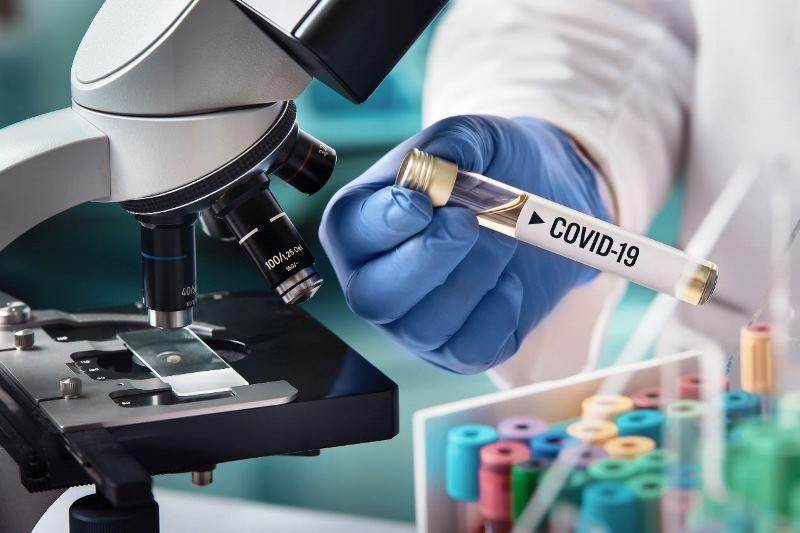 ES registra 3 mortes e 458 novos casos de Covid-19 neste sábado (23)