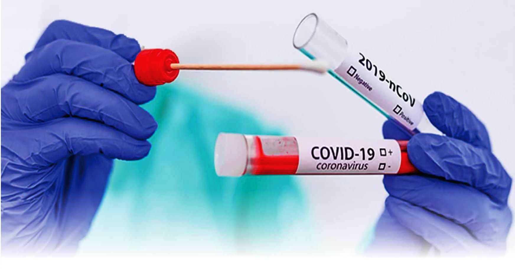 Com mais 2 infectados, Conceição da Barra chega a 2.059 casos de Covid-19