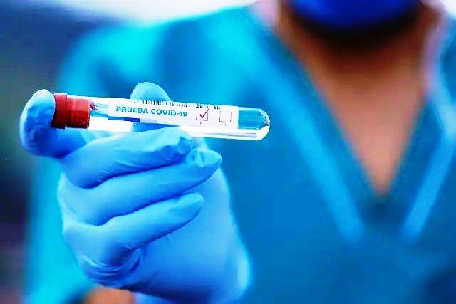 Conceição da Barra tem mais 1 infectado por Covid-19 e vai a 2.060 casos