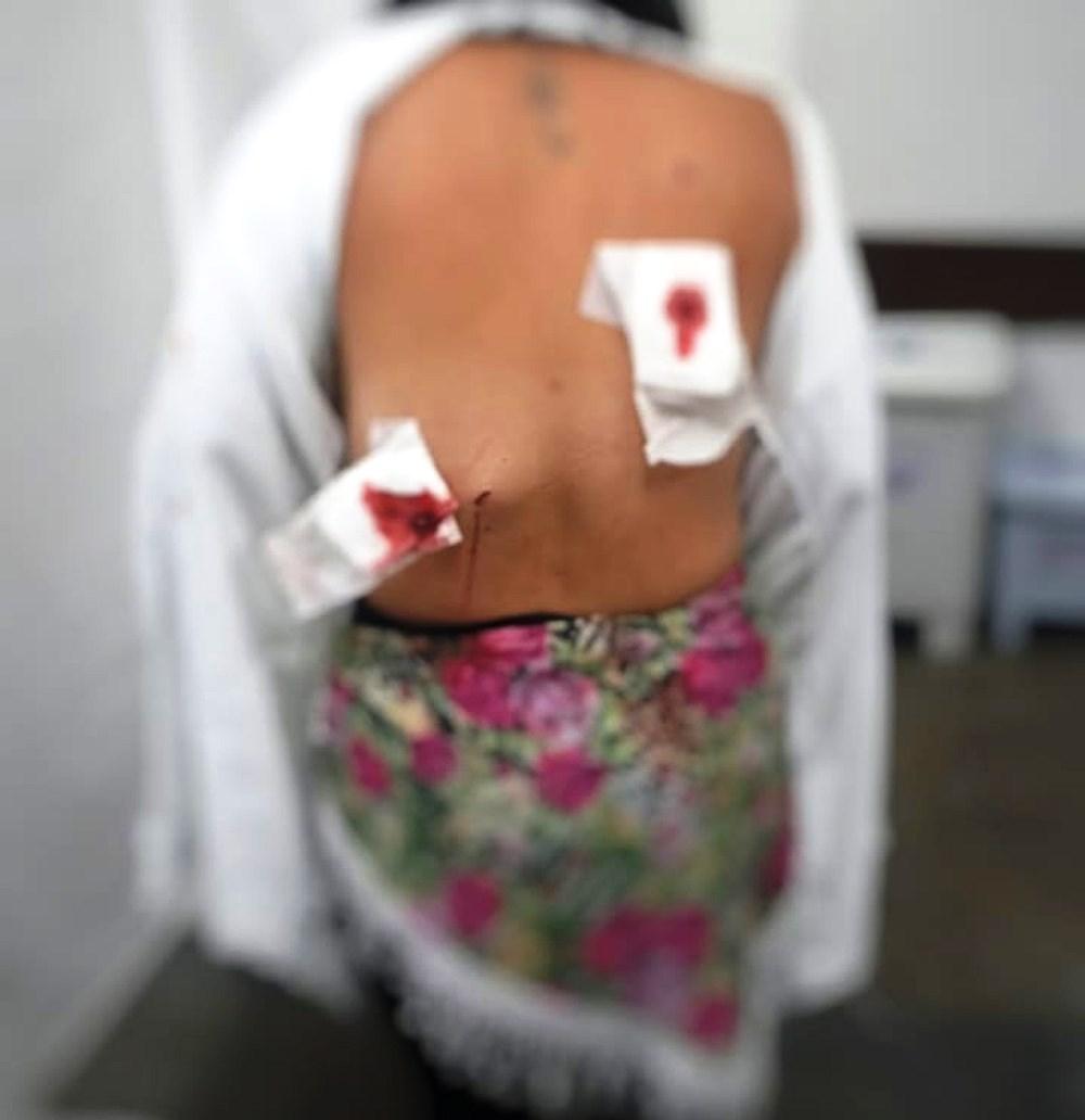 Mulher é esfaqueada nas costas por ex-namorado em Vila Velha, ES