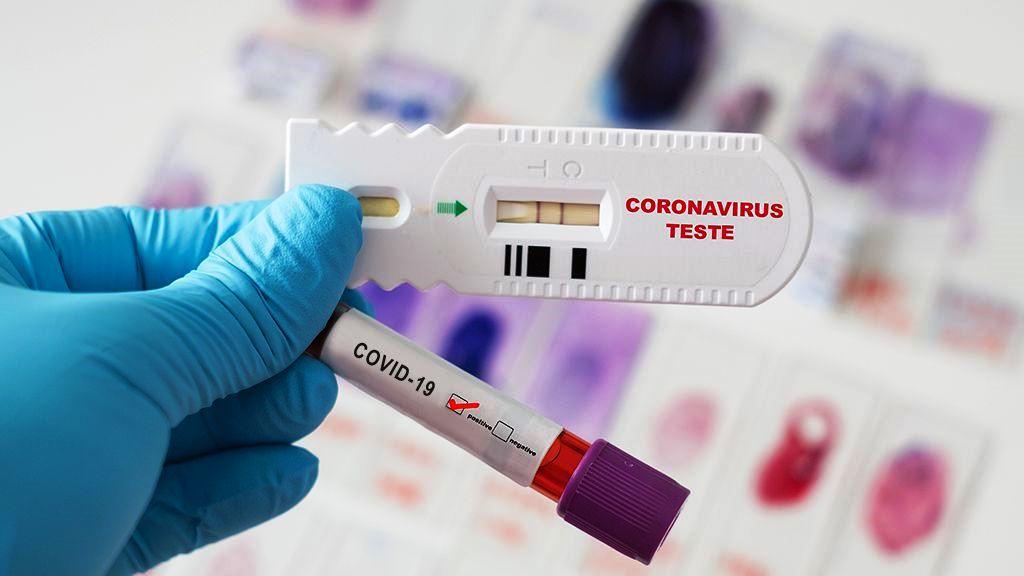 Conceição da Barra tem mais 1 infectado por Covid-19 e sobe para 2.143 casos