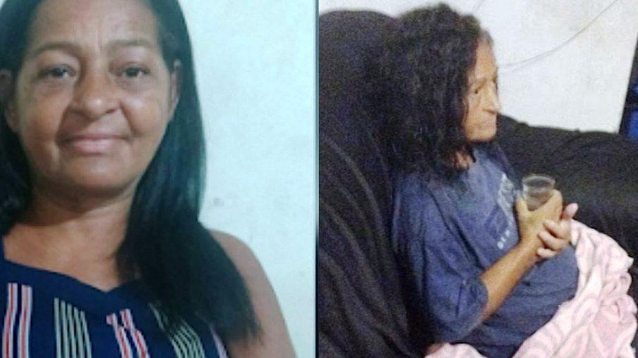 Mulher é enterrada viva na Bahia, escapa, mas fica com sequelas