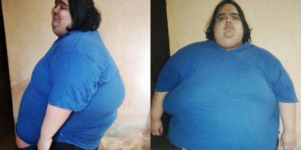 Jovem passa dos 300 kg e não consegue mais se pesar: ‘tenho muita fome’