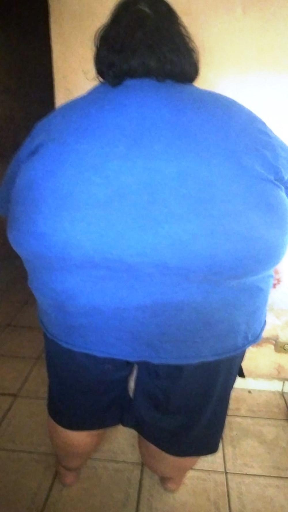Jovem passa dos 300 kg e não consegue mais se pesar: ‘tenho muita fome’