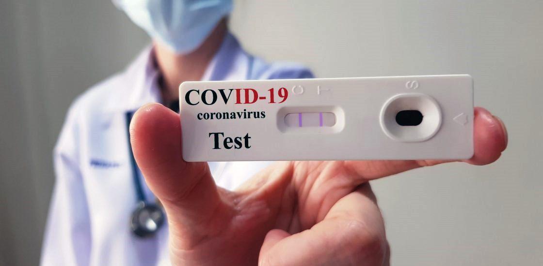 ES registra 3 mortes e 311 novos casos de Covid-19 nesta sexta-feira (17)