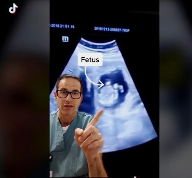 Após sangramentos, mulher descobre bebê crescendo em seu fígado